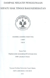 Image of Dampak Negatif Penggunaan Sepatu Hak Tinggi Bagi Kesehatan